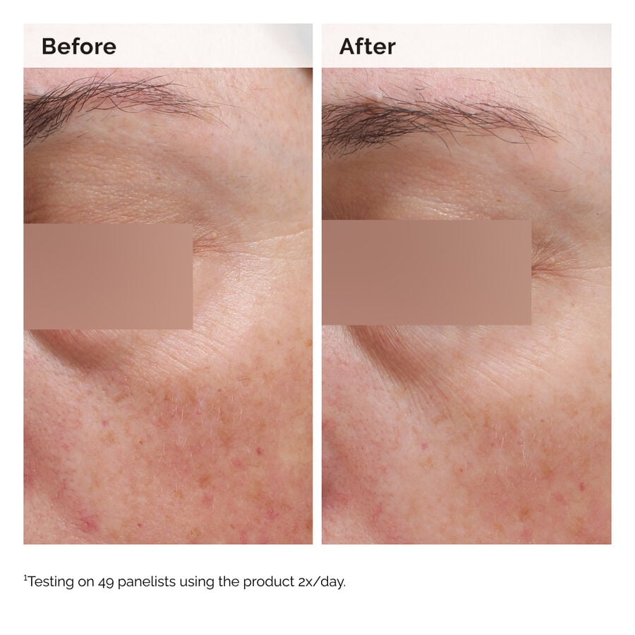 niacinamide-5-face-and-body-emulsion-n3 2024-08-23-ORD-Nia-5pct-Face-Body-B-A-Elasticity-Global-02-1x1.jpg