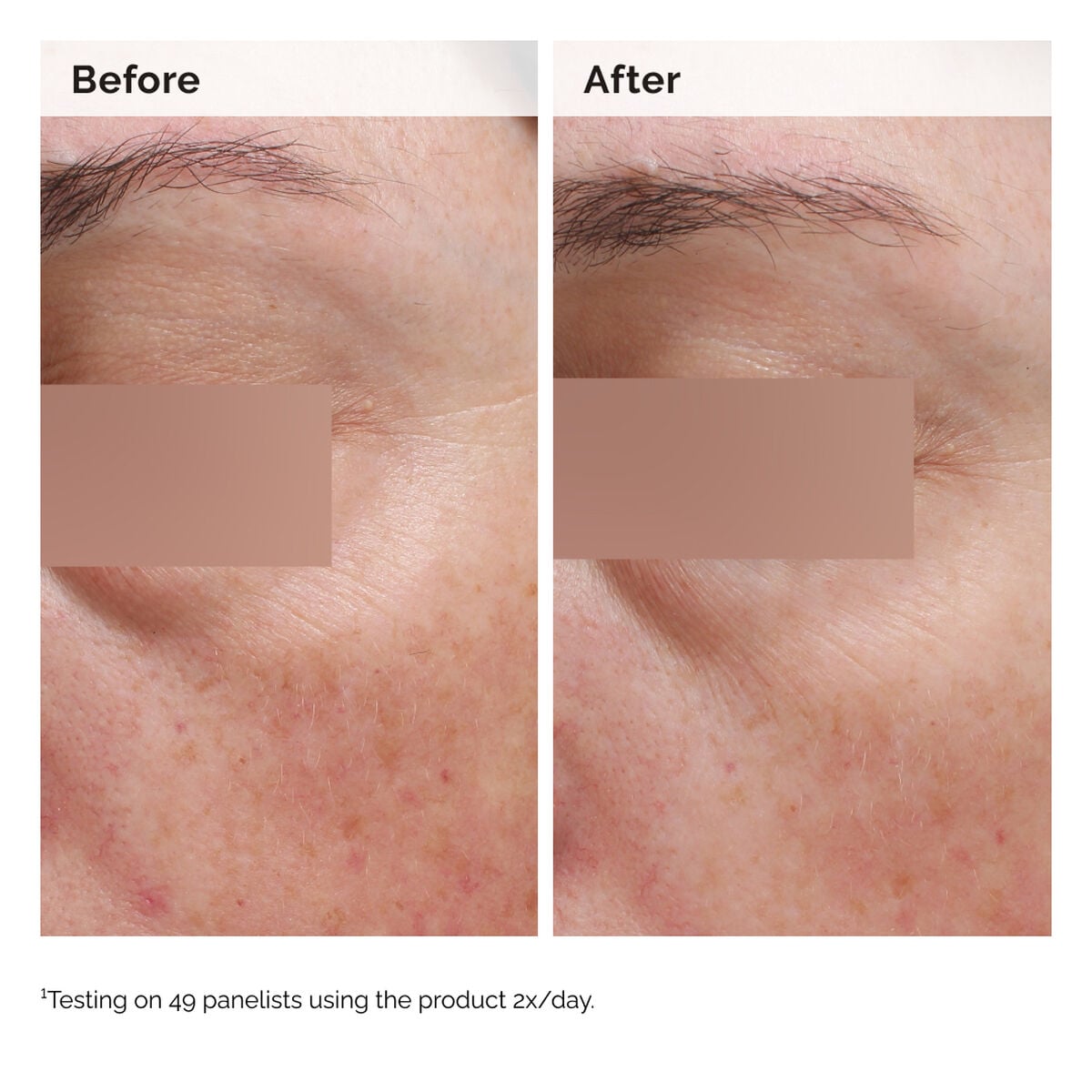 niacinamide-5-face-and-body-emulsion-n3 2024-08-23-ORD-Nia-5pct-Face-Body-B-A-Elasticity-Global-02-1x1.jpg