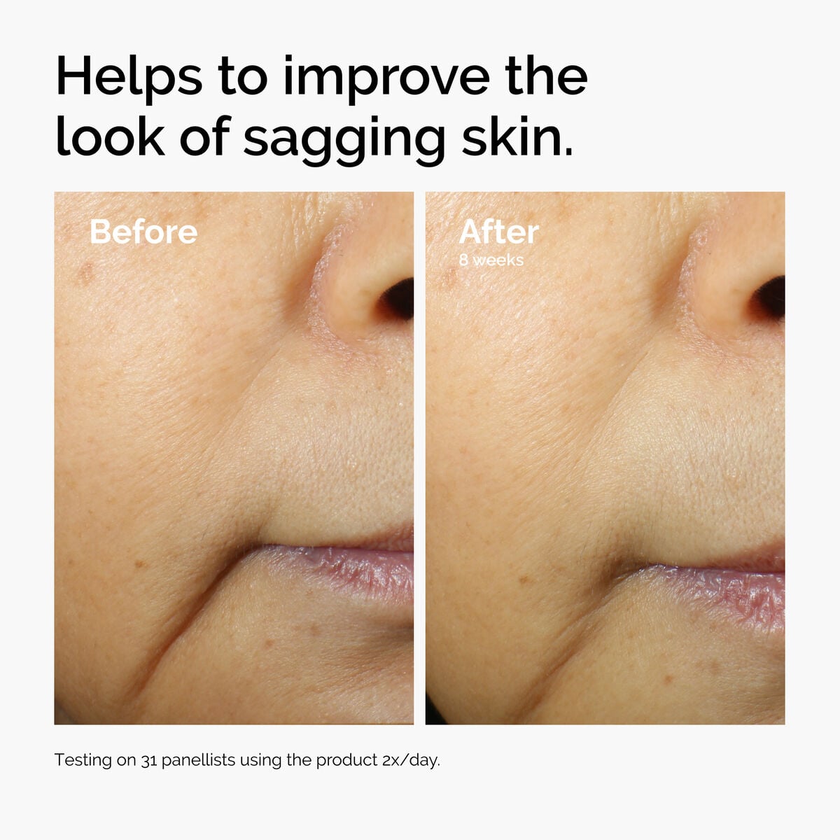 caffeine-3-escin-1-face-serum-a4 ord-caffeine-3pct-escin-1pct-face-serum-before-after-sagging.jpg