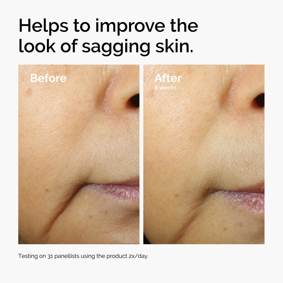 caffeine-3-escin-1-face-serum-q5 ord-caffeine-3pct-escin-1pct-face-serum-before-after-sagging.jpg
