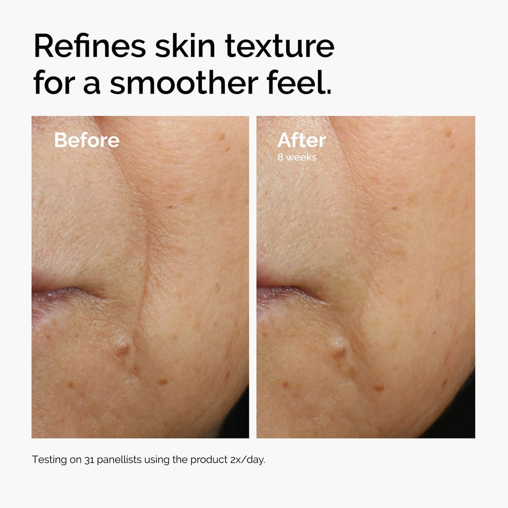caffeine-3-escin-1-face-serum-a4 ord-caffeine-3pct-escin-1pct-face-serum-before-after-texture.jpg