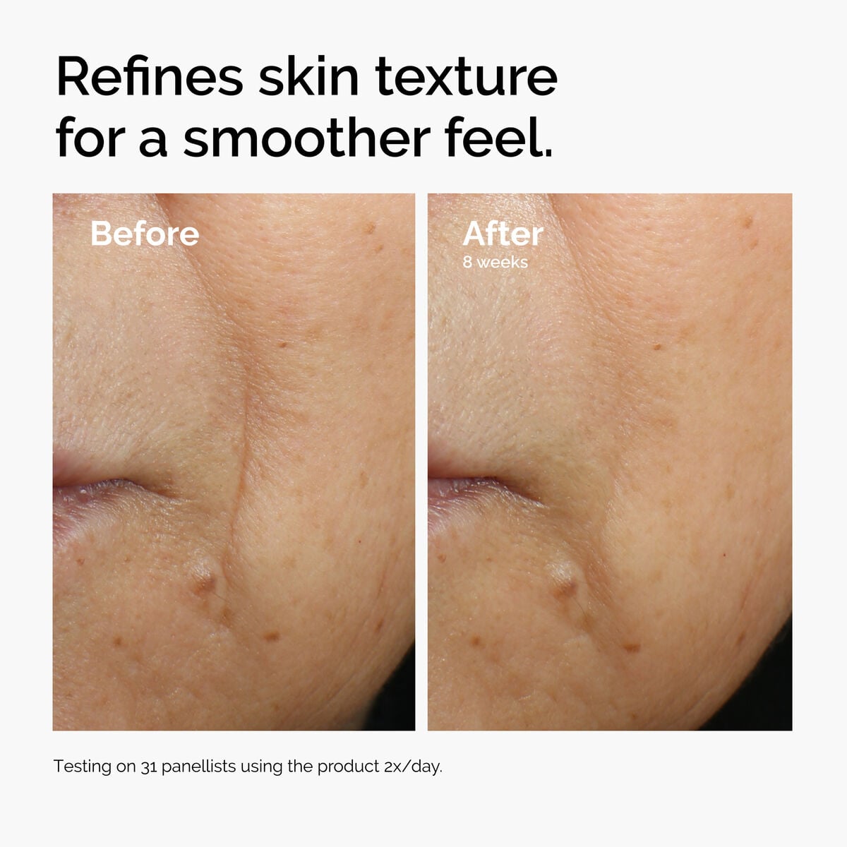 caffeine-3-escin-1-face-serum-a4 ord-caffeine-3pct-escin-1pct-face-serum-before-after-texture.jpg