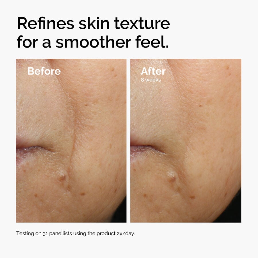 caffeine-3-escin-1-face-serum-q5 ord-caffeine-3pct-escin-1pct-face-serum-before-after-texture.jpg