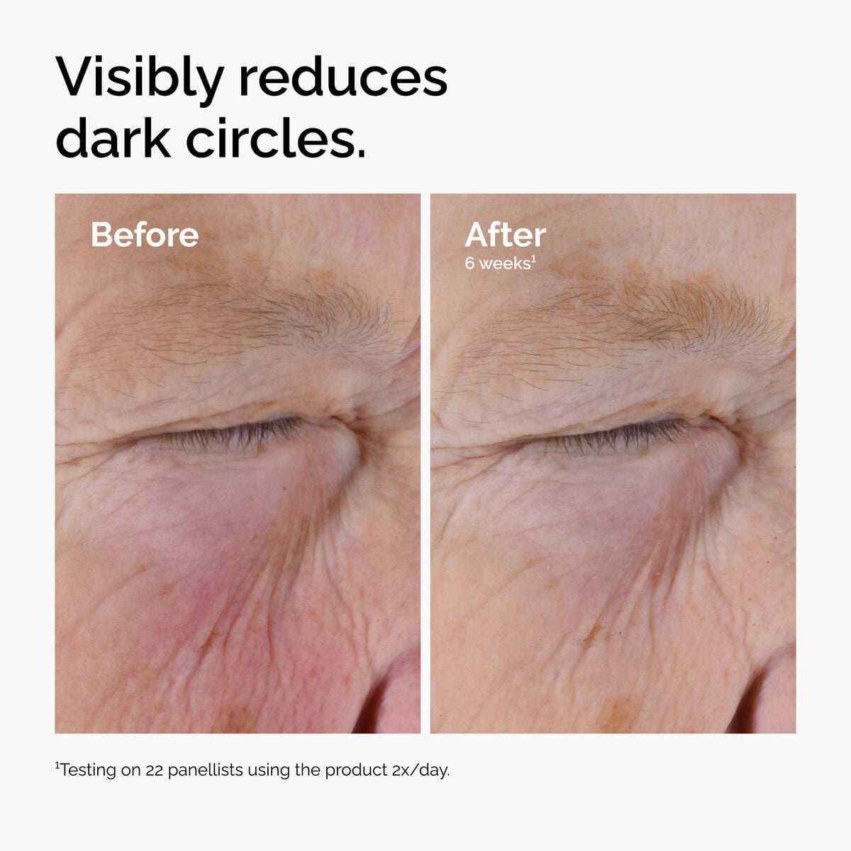 caffeine-solution-5-egcg-eye-serum-c5 ord-caffeine-solution-egcg-dark-circles-before-after.jpg