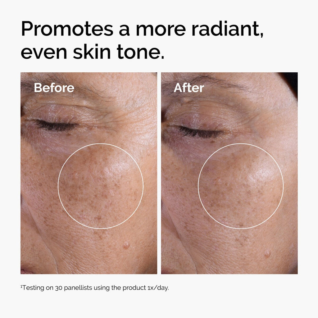 glycolic-acid-7-exfoliating-toner-o5 ord-glycolic-before-after-radiance.jpg