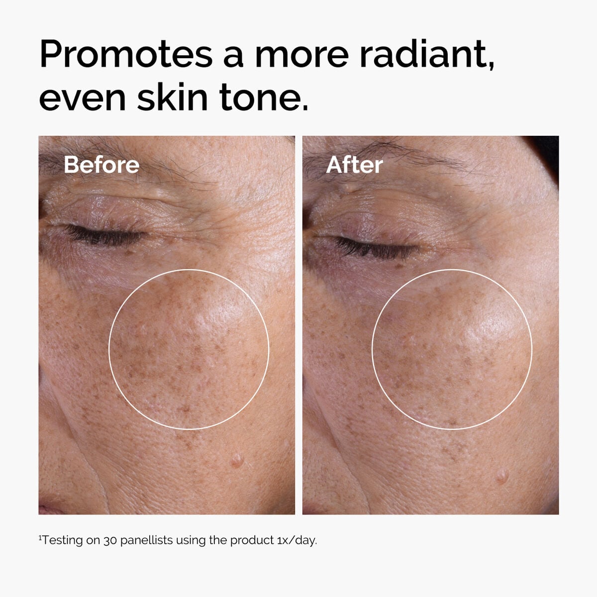 glycolic-acid-7-exfoliating-toner-o5 ord-glycolic-before-after-radiance.jpg