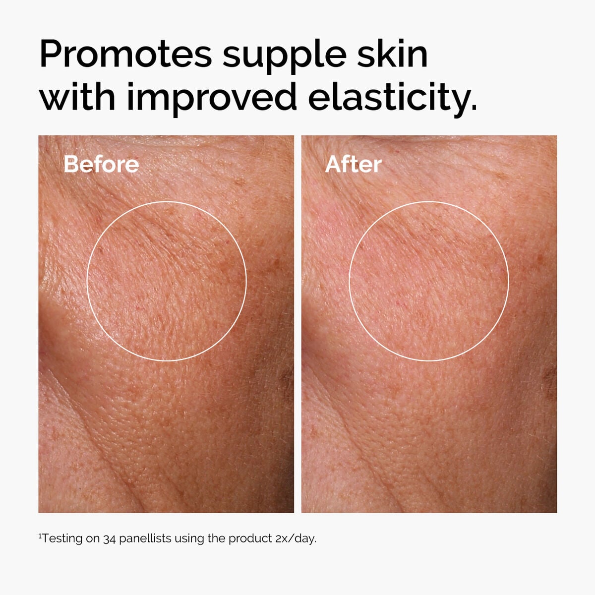 hyaluronic-acid-2-b5-with-ceramides-m9 ord-hyaluronic-acid-2pct-b5-hydrating-serum-before-after-elasticity.jpg
