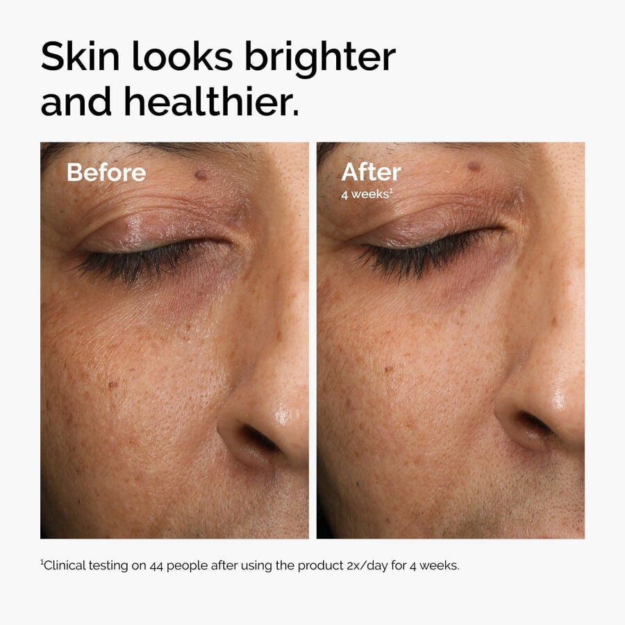 multi-antioxidant-radiance-serum-a0 ord-mars-before-after-healthy.jpg