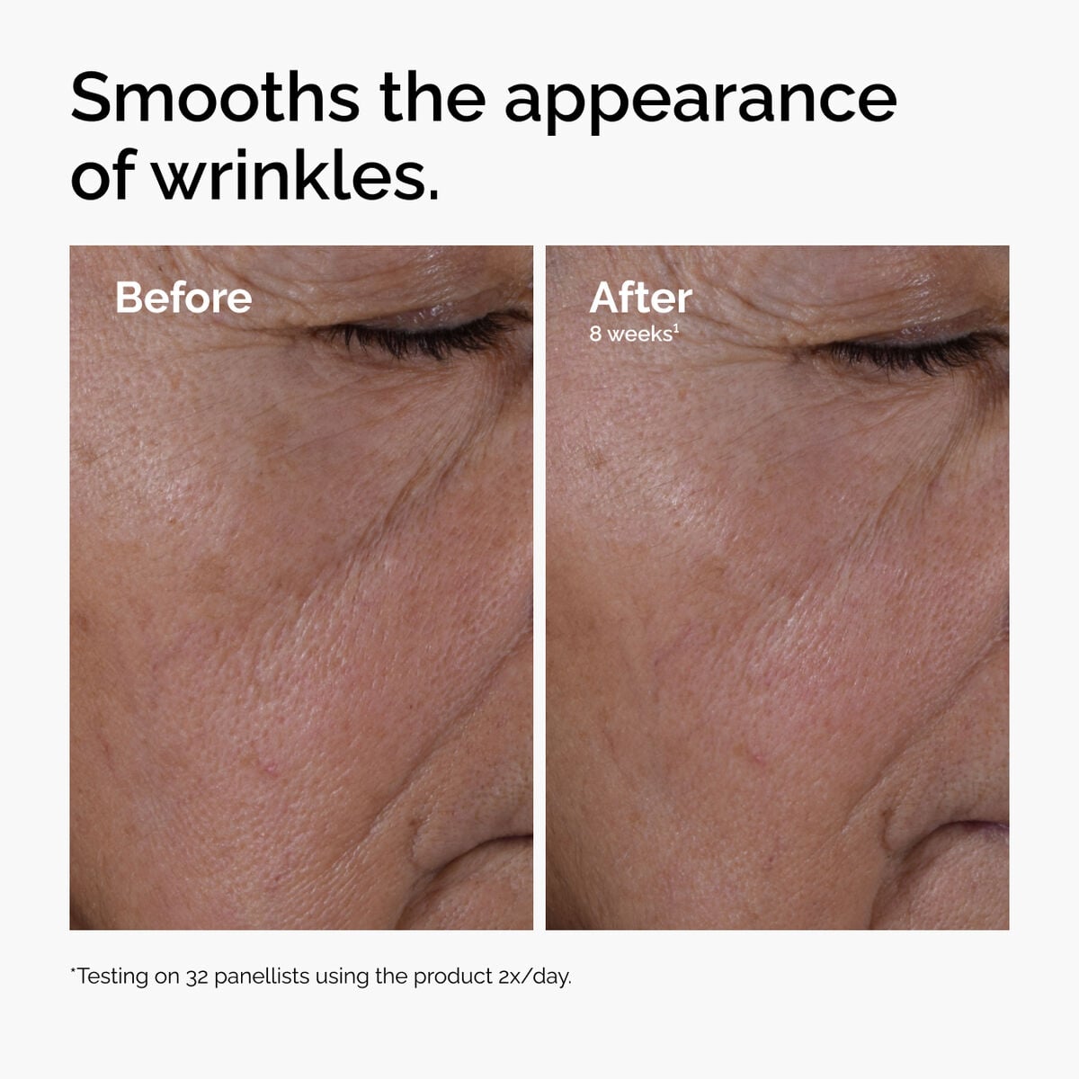 multi-peptide-ha-serum-g2 ord-multi-peptide-ha-serum-wrinkles-before-after.jpg