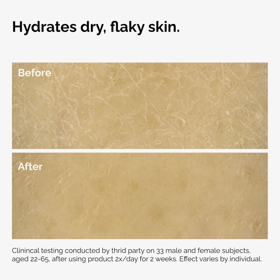 the-body-care-collection-s9 ord-natural-moisturizing-factors-inulin-body-before-after-graphic-02.jpg