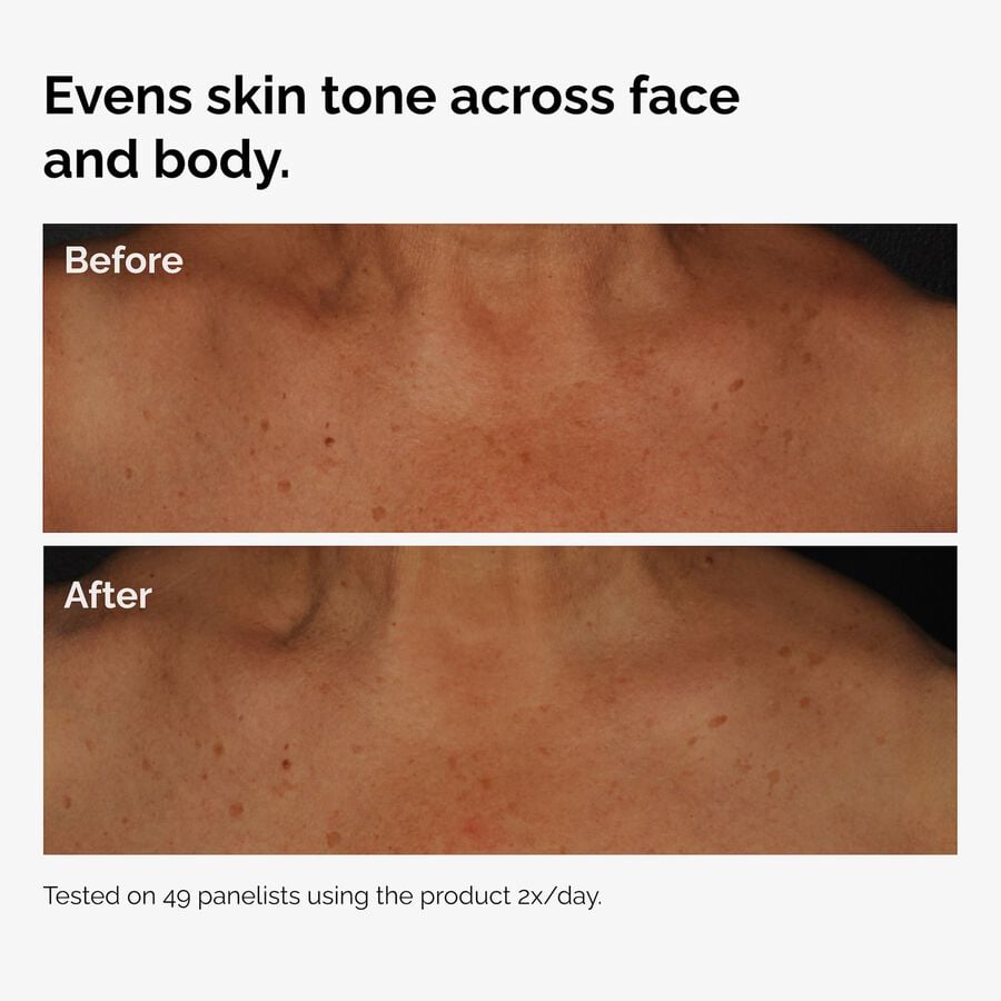 the-body-care-collection-s9 ord-niacinamide-face-body-serum-before-after-even-tone-graphic.jpg