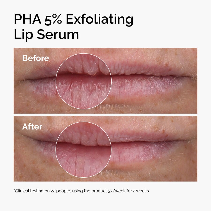 pha-5-exfoliating-lip-serum-z2 ord-pha-5pct-lip-exfoliating-serum-before-after.jpg