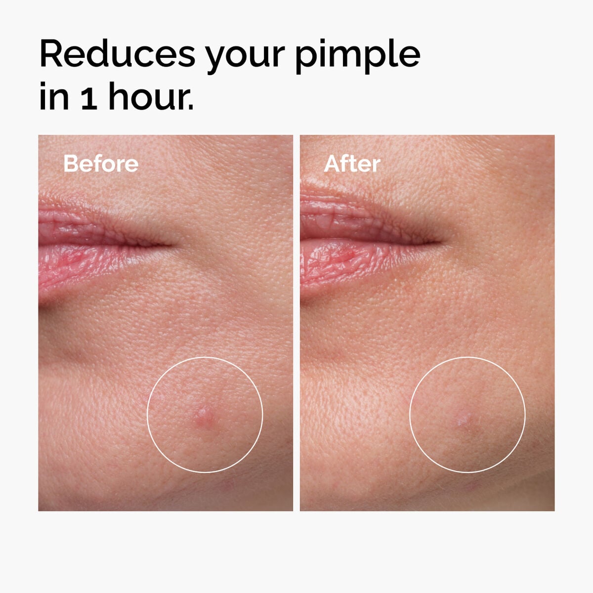 sulfur-10-powder-to-cream-concentrate-g4 ord-sulfur-10pct-powder-to-cream-concentrate-before-after-NA.jpg
